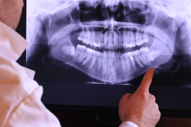 Best Emergency Denture Repair in Wells, MN