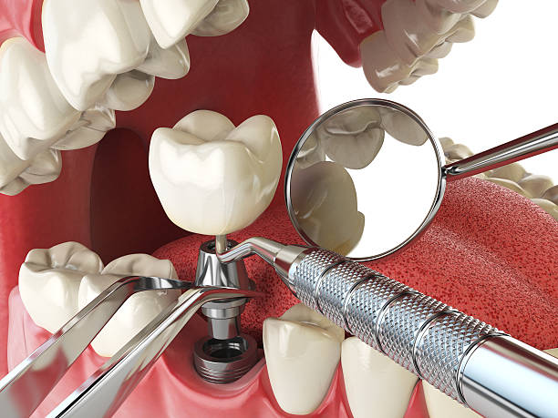 Best Emergency Treatment for Dental Infections or Abscesses in Wells, MN
